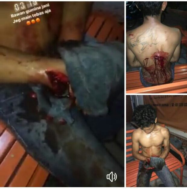 Berulah di Kosan, Pria Sumba Nyaris Tewas Ditebas
