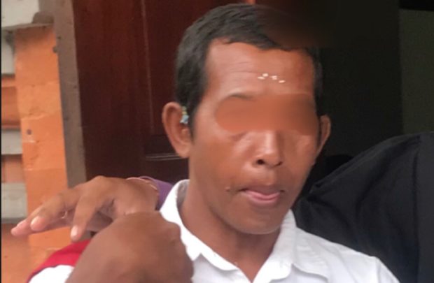 Remas Payudara Turis Tiongkok Tukang Kebun Divonis 5 Bulan