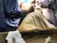 Dokter Ahli Bedah RSUD Larantuka Berhasil Keluarkan Anak Panah Dari Bahu Korban